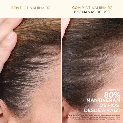 TONICO CAPILAR PANTENE BIOTINAMINA B3 52ML